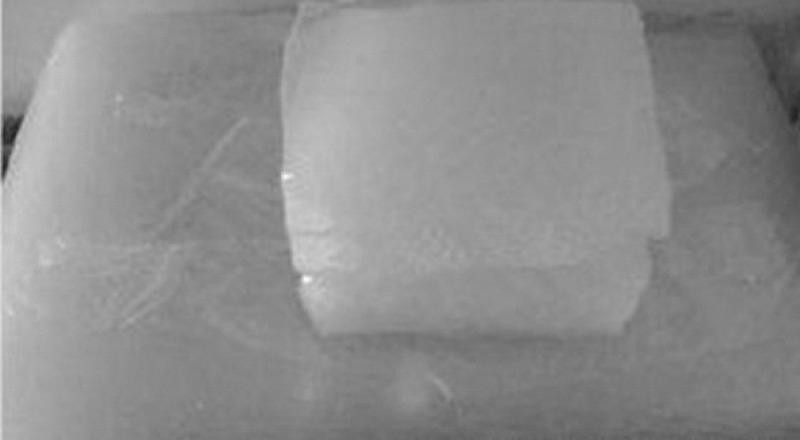 BR是什么？分類品種有哪些